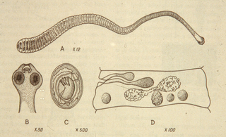 Illustration for article titled Tapeworm dies of Cancer, takes Man with it.